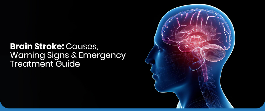Brain Stroke: Causes, Warning Signs & Emergency Treatment